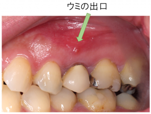 術前口腔内