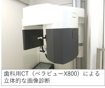 歯科用CT（ベラビューX800）の外観。立体的な画像診断が可能な高性能装置