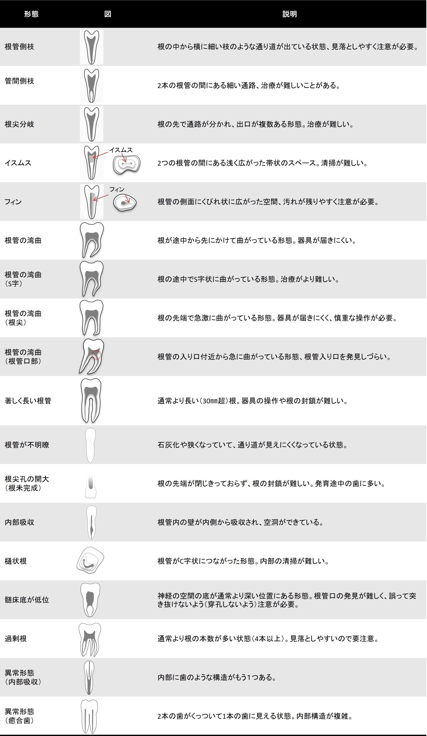 根管の複雑な形態や変異を図と説明で示した一覧表。側枝・分岐・湾曲・フィン・イスムス・癒合歯など、治療上の注意点が解説されている
